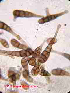 Alternaria mold spores -  &copy; 2001 Daniel Friedman  