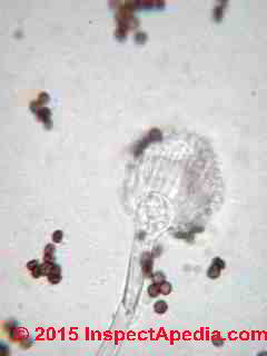 Aspergillus fumigatus conidiophore in our laboratory (C) Daniel Friedman