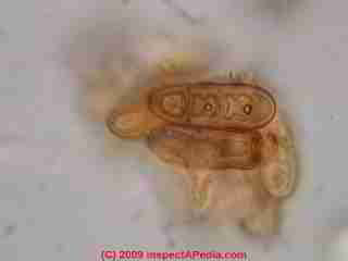 Bipolaris - Drechslera mold spore under the microscope (C) Daniel Friedman