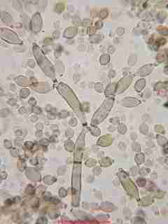 Cladosporium mold spores  &copy; Daniel Friedman 2001