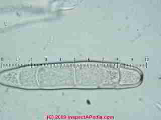 Ganoderma basidiospores  &copy; Daniel Friedman 2001