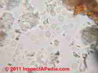 Mold spores under the microscope collected from house dust  (C) Daniel Friedman