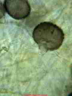 Epicoccum niger mold spore photograph  &copy; Daniel Friedman 2001
