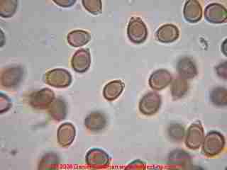 Ganoderma basidiospores  &copy; Daniel Friedman 2001