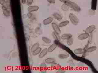 Ganoderma basidiospores  &copy; Daniel Friedman 2001