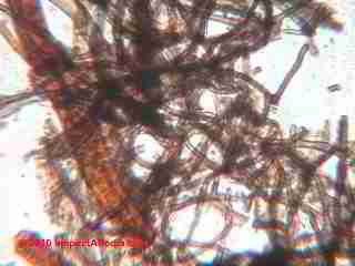 Brown hyphae (C) DanieL Friedman