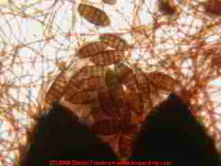 Photograph of an ascomycete mold Pleospora -  &copy; Daniel Friedman.