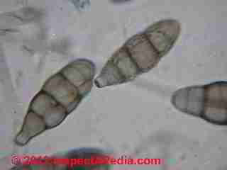 Ulocladium chartarum mold spores (C) D Friedman