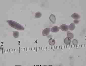 Cladosporium mold spores  &copy; Daniel Friedman 2001