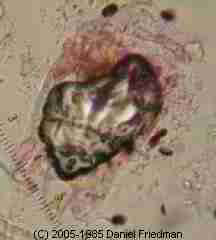 Photograph of a dust mite surrounded by debris, seen through the microscope