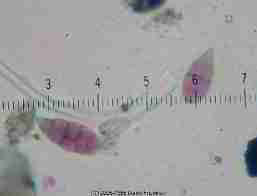 Alternaria mold spores -  &copy; 2001 Daniel Friedman