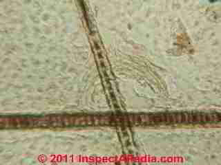 Cat dander in the microscope (C) D Friedman