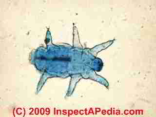 Dust mite photograph (C) Daniel Friedman