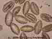 Tulip Poplar pollen