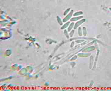 Photograph of Acremonium mold spores - © Daniel Friedman.