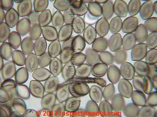 Chaetomium globosum spores (C) Daniel Friedman