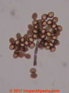 Chaetomium globosum spores (C) Daniel Friedman