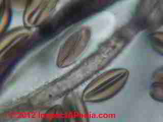 Chaetomium mold spore under the microscope (C) Daniel Friedman