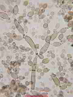 Cladosporium mold spores  © Daniel Friedman 2001