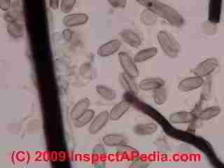 Ganoderma basidiospores  © Daniel Friedman 2001
