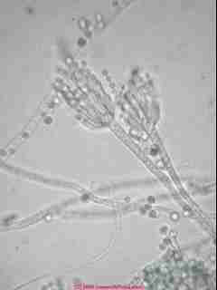 Photographs of spores of Penicillium sp. © Daniel Friedman 2001