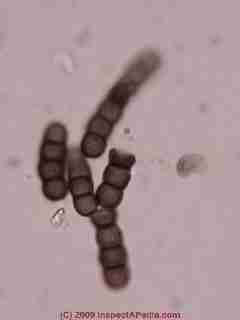 Photographs of spores of Torula mold © Daniel Friedman 2001