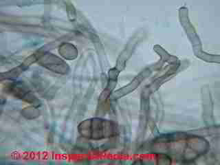 Uocladium-like mold spores - Daniel Friedman 08-17-01