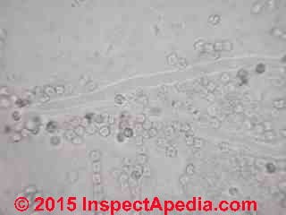 Wallemia serbi-like fungal spores & spore chains (C) Daniel Friedman