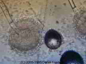 Aspergillus mold under the microscope (C) Daniel Friedman