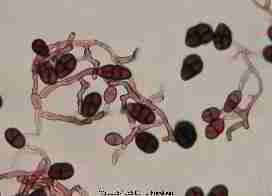 Uocladium mold spores - Daniel Friedman 08-17-01